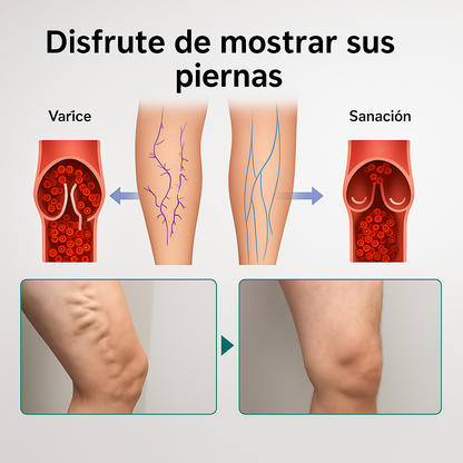 Parches para Varices - Varicose veins 12 u